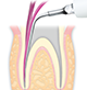 NSK E5 Aufsatz Satelec Dentalprodukte